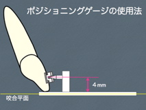 ポジショニングゲージ